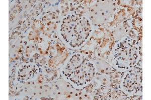 ABIN6268991 at 1/200 staining human kidney tissue sections by IHC-P. (PPP1R12A anticorps  (pThr853))