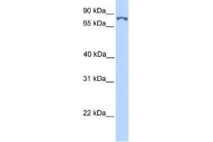 WB Suggested Anti-SSRP1 Antibody Titration:  0. (SSRP1 anticorps  (N-Term))