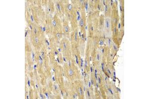 Immunohistochemistry of paraffin-embedded mouse heart using PLCG2 antibody (ABIN5971208) at dilution of 1/100 (40x lens). (Phospholipase C gamma 2 anticorps)