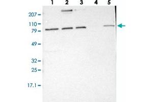 Western blot analysis of Lane 1: RT-4, Lane 2: EFO-21, Lane 3: A-431, Lane 4: Liver, Lane 5: Tonsil with ELFN2 polyclonal antibody  at 1:250-1:500 dilution. (ELFN2 anticorps)