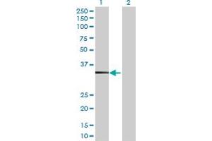 Western Blot analysis of TBC1D21 expression in transfected 293T cell line by TBC1D21 MaxPab polyclonal antibody. (TBC1D21 anticorps  (AA 1-336))