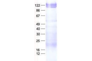 Validation with Western Blot