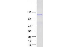 Validation with Western Blot