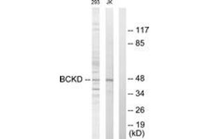 Western blot analysis of extracts from Jurkat/293 cells, using BCKD Antibody . (BCKDK anticorps  (AA 11-60))