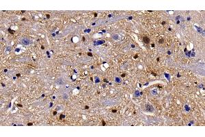 Detection of S100B in Mouse Cerebrum Tissue using Polyclonal Antibody to S100 Calcium Binding Protein B (S100B)