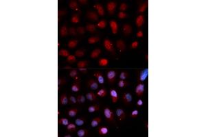 Immunofluorescence analysis of U2OS cells using ETV4 antibody. (ETV4 anticorps)