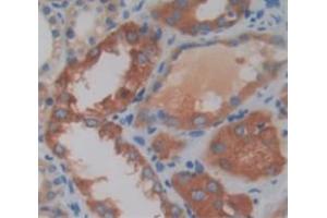 IHC-P analysis of Human Tissue, with DAB staining. (Kazald1 anticorps  (AA 31-304))