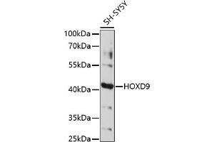 Western blot analysis of extracts of SH-SY5Y cells, using HOXD9 antibody (ABIN7267776) at 1:1000 dilution. (HOXD9 anticorps  (AA 100-200))