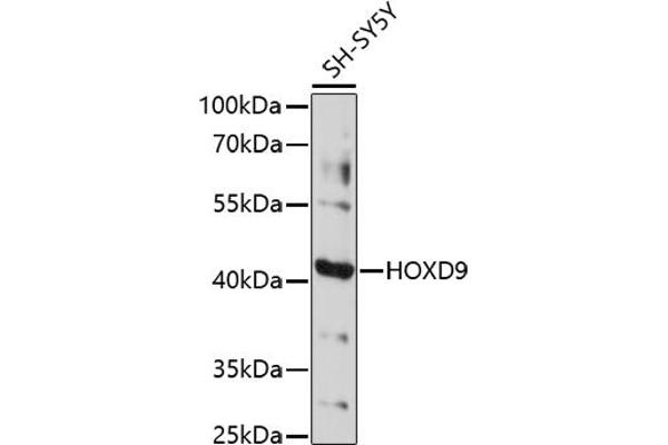 HOXD9 Antikörper  (AA 100-200)