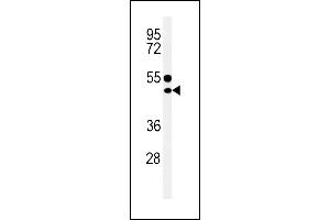 CD1E Antibody (Center) (ABIN653900 and ABIN2843142) western blot analysis in MDA-M cell line lysates (35 μg/lane). (CD1e anticorps  (AA 184-212))