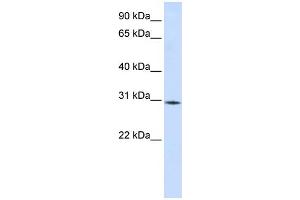 WB Suggested Anti-RBM7 Antibody Titration:  0. (RBM7 anticorps  (Middle Region))