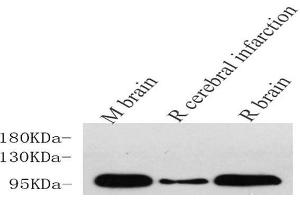 Western Blot analysis of various samples using DLG4 Polyclonal Antibody at dilution of 1:750. (DLG4 anticorps)