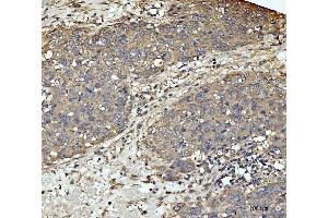 IHC analysis of MEK3 using anti-MEK3 antibody (ABIN3043874). (MAP2K3 anticorps  (C-Term))
