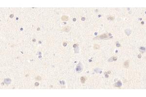 Detection of MYOM2 in Human Cerebrum Tissue using Polyclonal Antibody to Myomesin 2 (MYOM2) (MYOM2 anticorps  (AA 1130-1434))