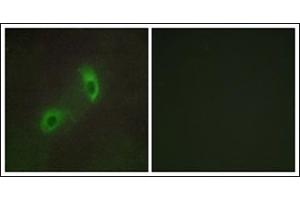 Immunofluorescence analysis of HuvEc cells, using HGS Antibody.