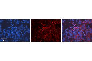 Rabbit Anti-CCND1 Antibody Catalog Number: ARP30163_P050 Formalin Fixed Paraffin Embedded Tissue: Human Liver Tissue Observed Staining: Cytoplasm, Plasma membrane Primary Antibody Concentration: 1:600 Other Working Concentrations: N/A Secondary Antibody: Donkey anti-Rabbit-Cy3 Secondary Antibody Concentration: 1:200 Magnification: 20X Exposure Time: 0.