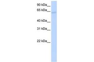 Image no. 1 for anti-TNF Receptor-Associated Factor 6 (TRAF6) (C-Term) antibody (ABIN6742184) (TRAF6 anticorps  (C-Term))