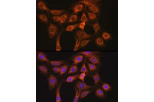 Immunofluorescence analysis of C6 using R1 antibody (ABIN3023489, ABIN3023490, ABIN3023491 and ABIN6220077) at dilution of 1:50.
