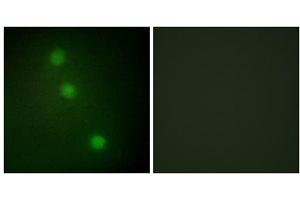 Immunofluorescence analysis of HUVEC cells, using ATF1 antibody. (AFT1 anticorps  (C-Term))