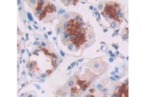 IHC-P analysis of Human Tissue, with DAB staining. (alpha Defensin 1 anticorps  (AA 20-94))