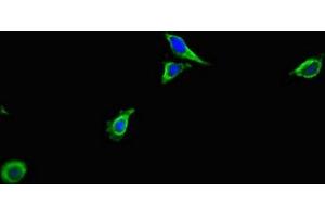 Immunofluorescent analysis of Hela cells using ABIN7143102 at dilution of 1:100 and Alexa Fluor 488-congugated AffiniPure Goat Anti-Rabbit IgG(H+L) (ACTR3 anticorps  (AA 352-409))