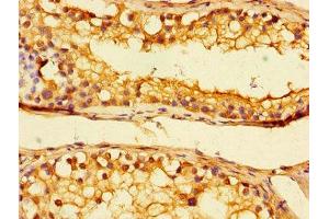 Immunohistochemistry of paraffin-embedded human testis tissue using ABIN7174530 at dilution of 1:100 (UBA6 anticorps  (AA 1-44))