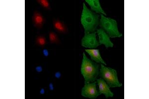 ABIN6258408 and ABIN6275691 staining  cells by IF/ICC. (ZNF420 anticorps  (Internal Region))