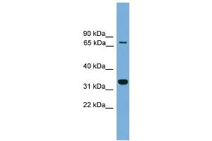 WB Suggested Anti-BCAN Antibody Titration: 0. (BCAN anticorps  (Middle Region))