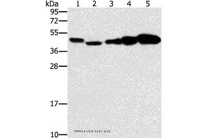 Western blot analysis of Hela, Raji, Jurkat, A549 and NIH/3T3 cell, using PPAT Polyclonal Antibody at dilution of 1:250 (PPAT anticorps)