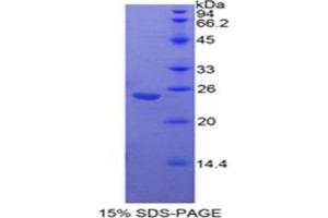 SDS-PAGE analysis of Mouse Insulin Like Growth Factor Binding Protein 7 (IGFBP7) Protein. (IGFBP7 Protéine)