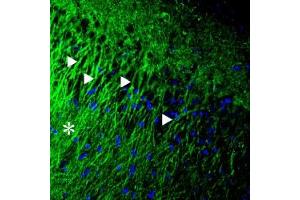 Expression of P2X2 receptor in rat hippocampusImmunohistochemical staining of rat hippocampus with Anti-P2X2 Receptor Antibody (ABIN7237790, ABIN7316699 and ABIN7316700).