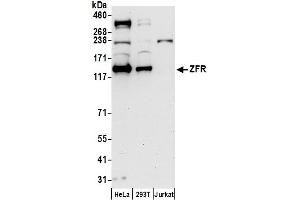 anti-Zinc Finger RNA Binding Protein (ZFR) (AA 1-50) antibody