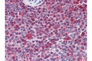 Human Spleen (formalin-fixed, paraffin-embedded) stained with PARP1followed by biotinylated goat anti-rabbit IgG secondary antibody, alkaline phosphatase-streptavidin and chromogen. (PARP1 anticorps  (N-Term))