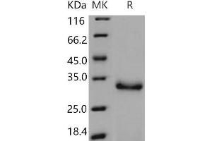 Western Blotting (WB) image for Protease, serine, 2 (Trypsin 2) (PRSS2) (Active) protein (His tag) (ABIN7197544)