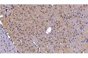 Detection of DDX58 in Mouse Cerebrum Tissue using Polyclonal Antibody to Probable ATP-dependent RNA Helicase DDX58 (DDX58) (DDX58 anticorps  (AA 1-211))