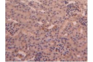 Detection of CPB2 in Mouse Kidney Tissue using Polyclonal Antibody to Carboxypeptidase B2 (CPB2)
