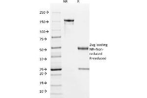 SDS-PAGE Analysis Purified HPV-16 Mouse Monoclonal Antibody (HPV16/1295). (HPV16 anticorps)