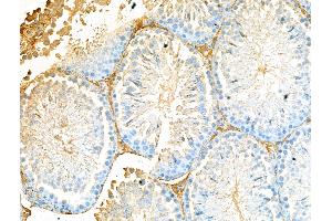 ABIN7094535 and ABIN7098584 at 1/100 staining Rat testis tissue by IHC-P. (APH1A anticorps  (C-Term))