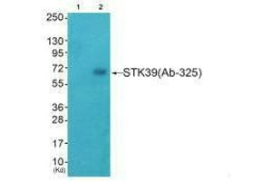 Western blot analysis of extracts from HeLa cells (Lane 2), using STK39 (Ab-325) antiobdy. (STK39 anticorps  (Ser325))