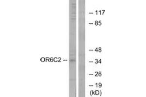 Western blot analysis of extracts from HT-29 cells, using OR6C2 Antibody.