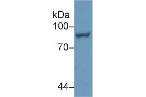 Western Blot; Sample: Human Jurkat cell lysate; Primary Ab: 2µg/ml Rabbit Anti-Human STAT4 Antibody Second Ab: 0. (STAT4 anticorps  (AA 505-737))