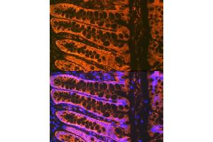 Immunofluorescence analysis of rat rectum using  Rabbit mAb (ABIN7265434) at dilution of 1:100 (40x lens).