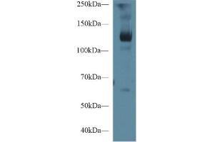 Western blot analysis of Pig Skeletal muscle lysate, using Human LIFR Antibody (1 µg/ml) and HRP-conjugated Goat Anti-Rabbit antibody ( (LIFR anticorps  (AA 692-833))