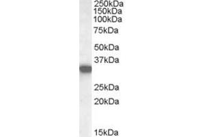ABIN238619 (0. (HADH anticorps  (Internal Region))