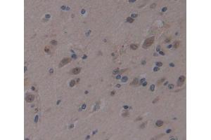 Used in DAB staining on fromalin fixed paraffin- embedded brain tissue (AHRR anticorps  (AA 1-182))