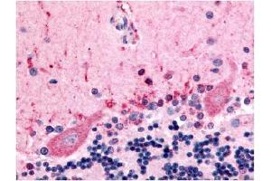 Immunohistochemical staining of human brain (Purkinje Neurons) using anti-CELSR3 antibody (CELSR3 anticorps  (N-Term))