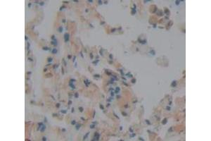 Figure. (Peroxidasin anticorps  (AA 76-260))