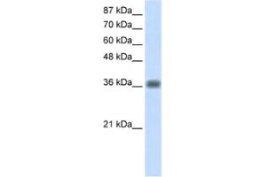 Western Blotting (WB) image for anti-Kelch Domain Containing 8A (KLHDC8A) antibody (ABIN2462280) (KLHDC8A anticorps)