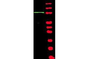 Western blot using Affinity Purified anti-BACH1 antibody shows detection of a band at ~105 kDa (lane 1) corresponding to human BACH1 present in a 293 whole cell lysate (arrowhead). (BRIP1 anticorps  (Isoform 1))