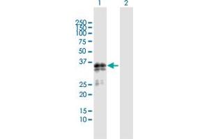 Western Blot analysis of SGCG expression in transfected 293T cell line by SGCG MaxPab polyclonal antibody. (SGCG anticorps  (AA 1-291))